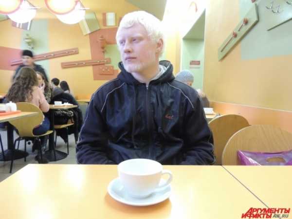 Продолжительность жизни альбиносов
